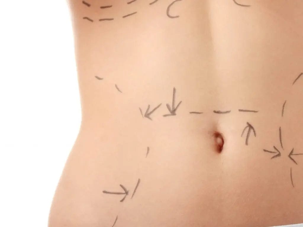 MLD for Swelling & Fibrosis